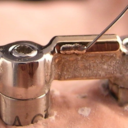 Laser Welders Are Crucial for Orthodontic Labs